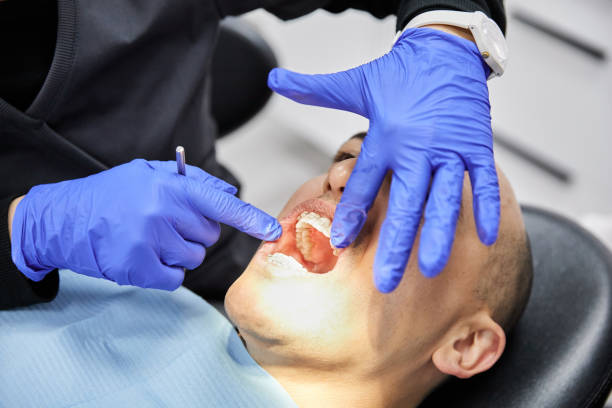 Best Emergency Wisdom Teeth Removal in Lakeview, GA